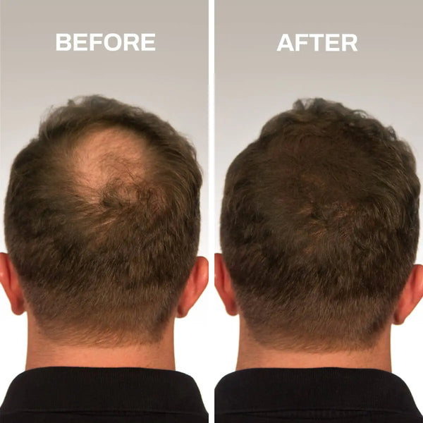 HEADJOB™ Hair Fibers (U905040 Private Listing)