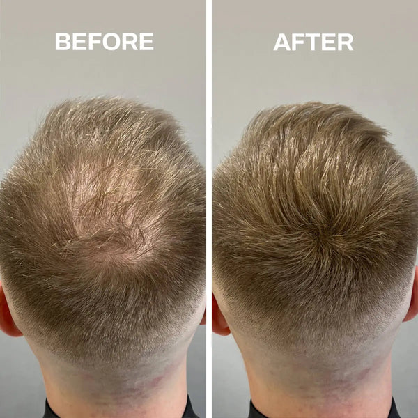 HEADJOB™ Hair Fibers (U905040 Private Listing)